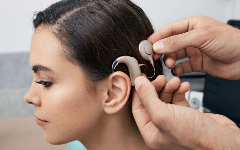 Cochlear Implant Support